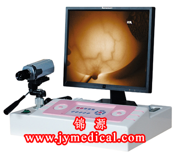 JY-2501B新型便携式红外乳腺诊断仪