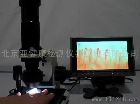 北京微循环检测仪（便携版上市）