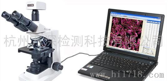 MIA-V型数字显微图像分析系统