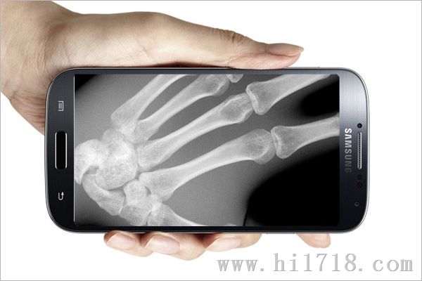 新能手机成像的便携式X光透视仪