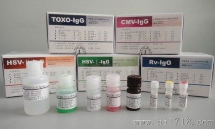 糖类原CA 19-9检测试剂盒（酶联免疫法）