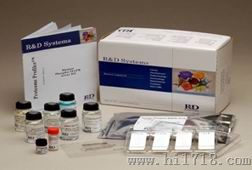 人B细胞分化因子(BCDF)ELISA试剂盒
