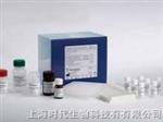 人环磷酸腺苷Elisa试剂盒,(cAMP)Elisa试剂盒