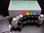 人细胞角蛋白21-1片段ELISA检测试剂盒