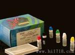 人白介素17 ELISA试剂盒