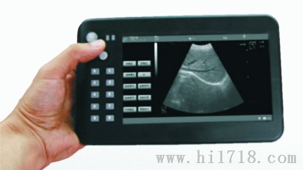 UPad-2V兽用掌上平板式超声显像诊断仪(B超,彩超,超声诊断仪,黑白超)