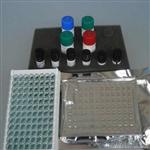 人补体蛋白4()ELISA检测试剂盒厂家代测