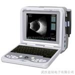 眼科超声诊断仪，国产精品AB超声诊断仪
