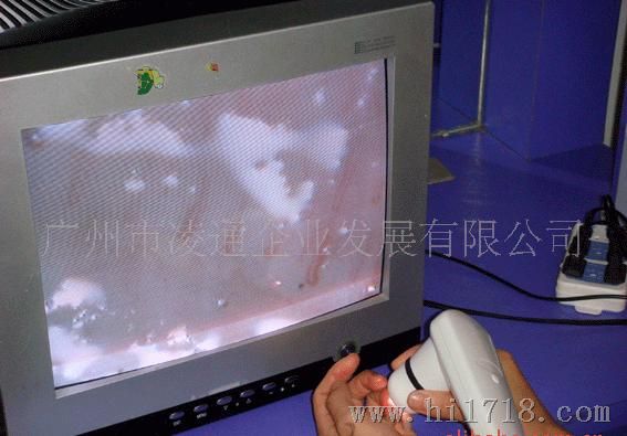 大量3XX起价微循环