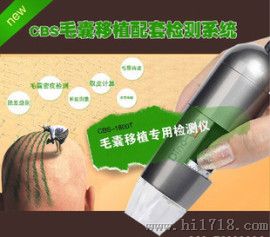 毛发移植检测仪CBS-1600T