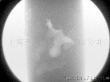 便携式X光检测仪